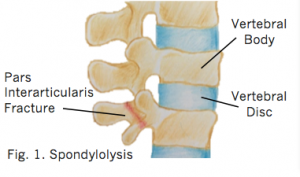 spondy